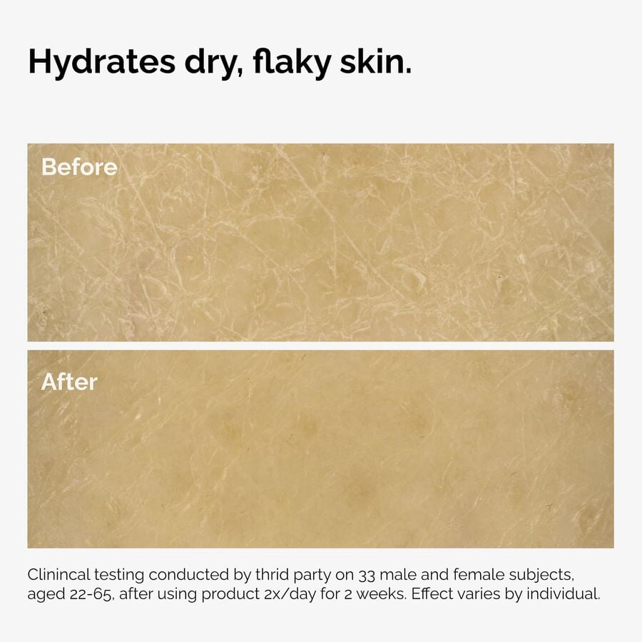the-body-care-collection-e1 ord-natural-moisturizing-factors-inulin-body-before-after-graphic-02.jpg