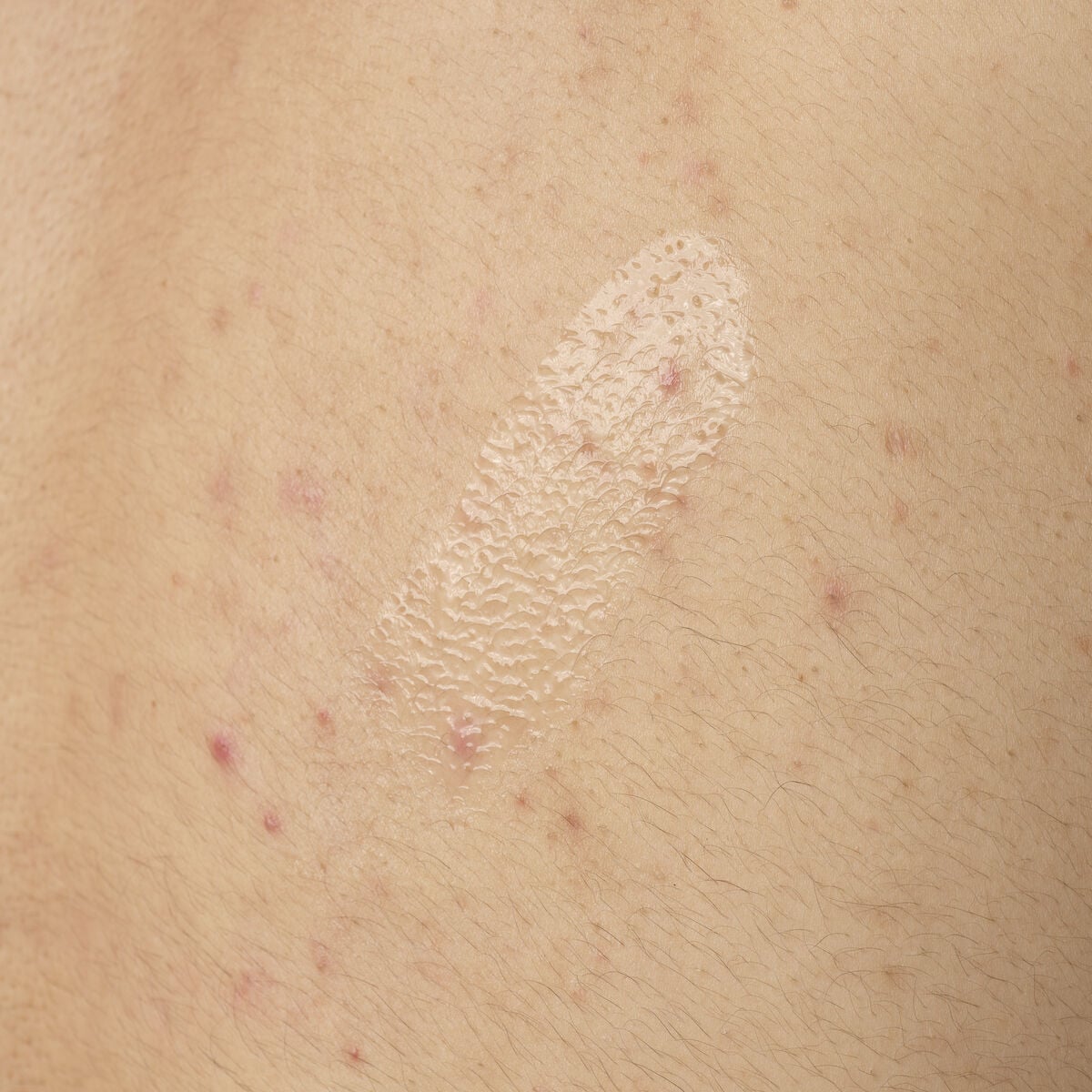 salicylic-acid-0-5-body-serum-m9 ORD-salicylic-acid-05-body-240ml-application.jpg
