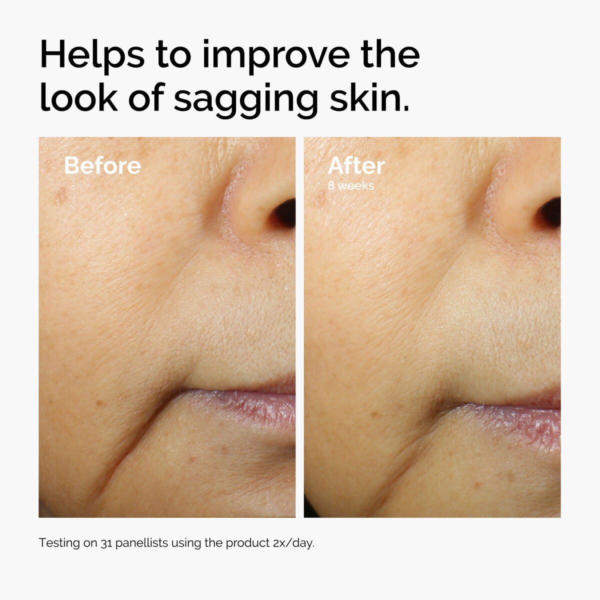 caffeine-3-escin-1-face-serum-g1 ord-caffeine-3pct-escin-1pct-face-serum-before-after-sagging.jpg