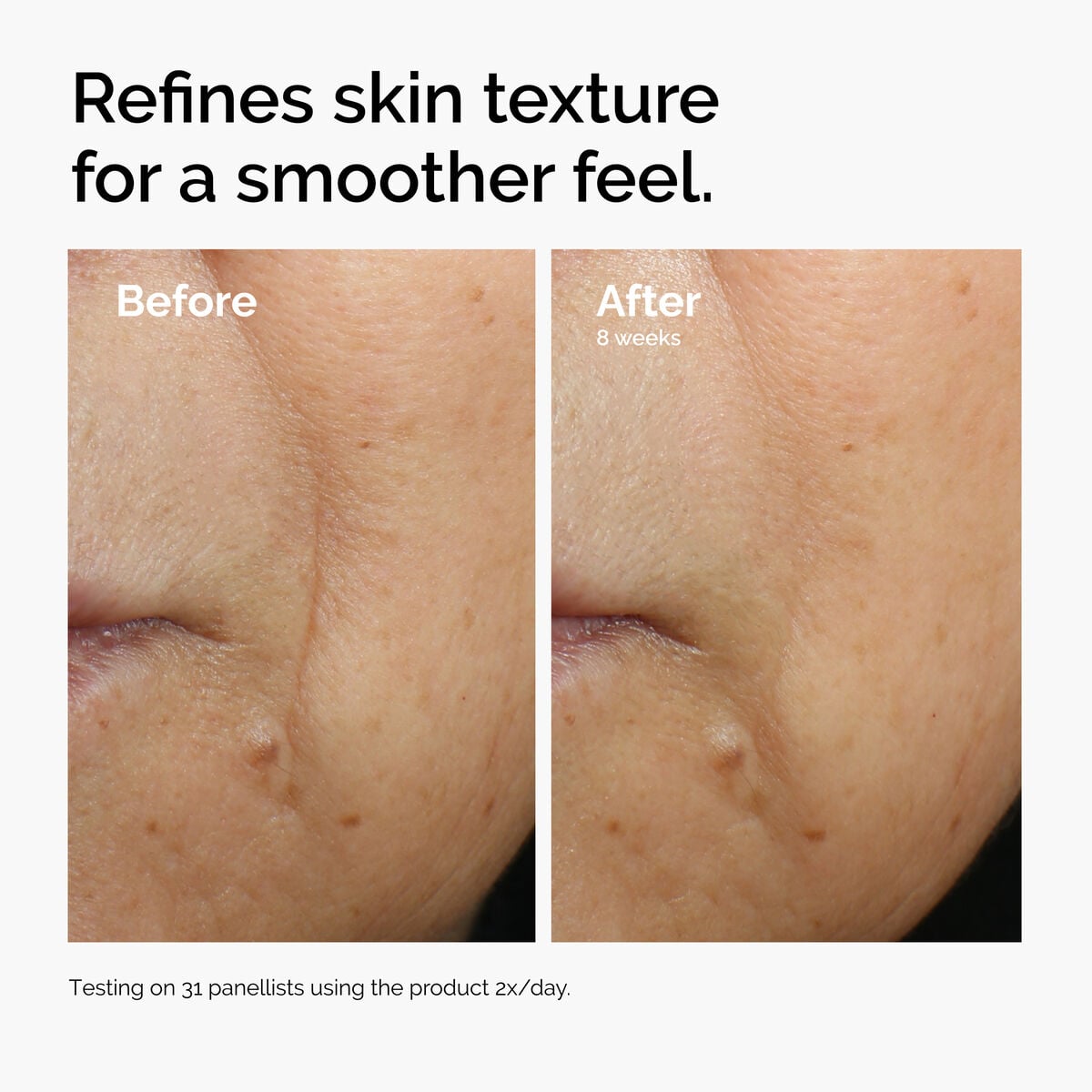 caffeine-3-escin-1-face-serum-g1 ord-caffeine-3pct-escin-1pct-face-serum-before-after-texture.jpg