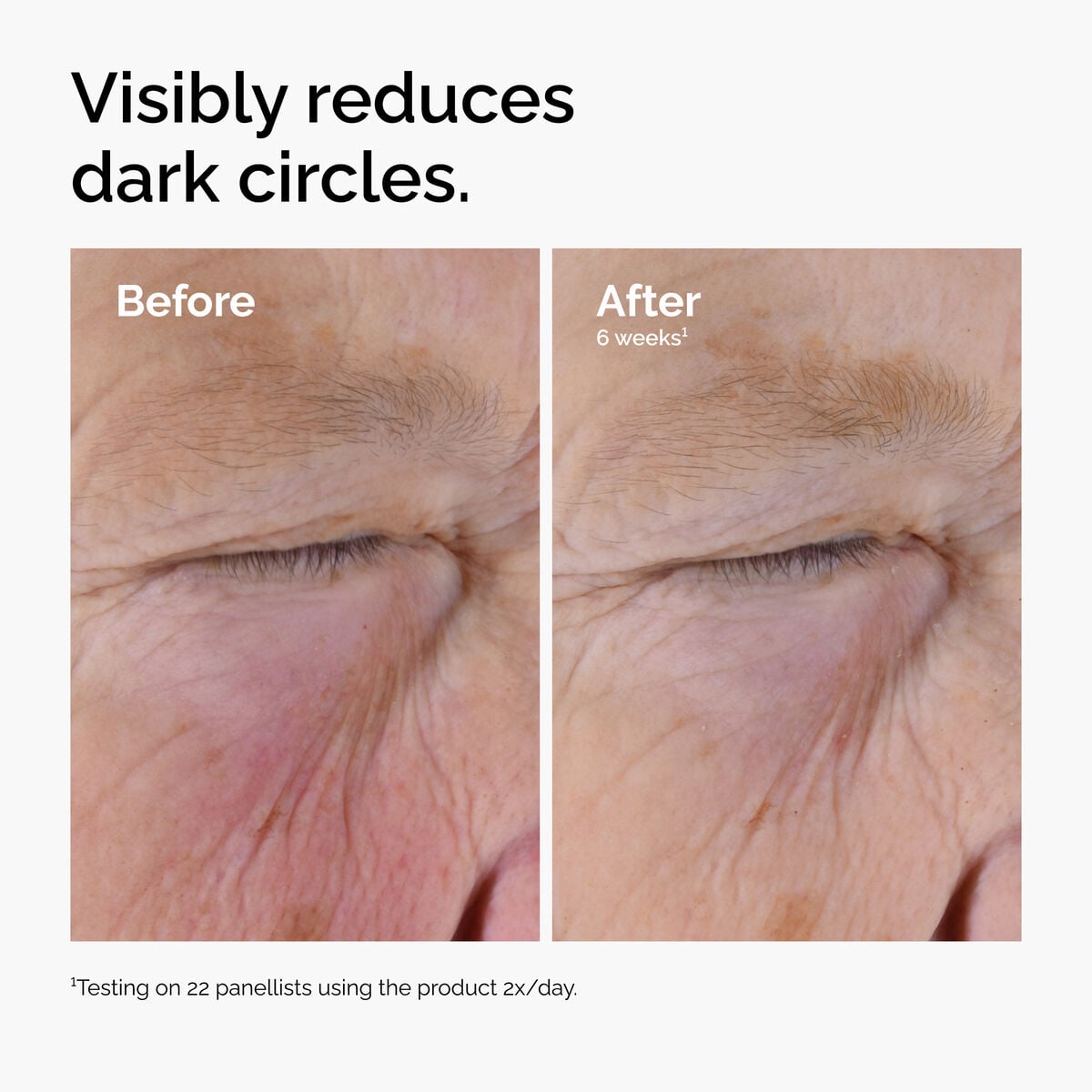 caffeine-solution-5-egcg-eye-serum-r1 ord-caffeine-solution-egcg-dark-circles-before-after.jpg