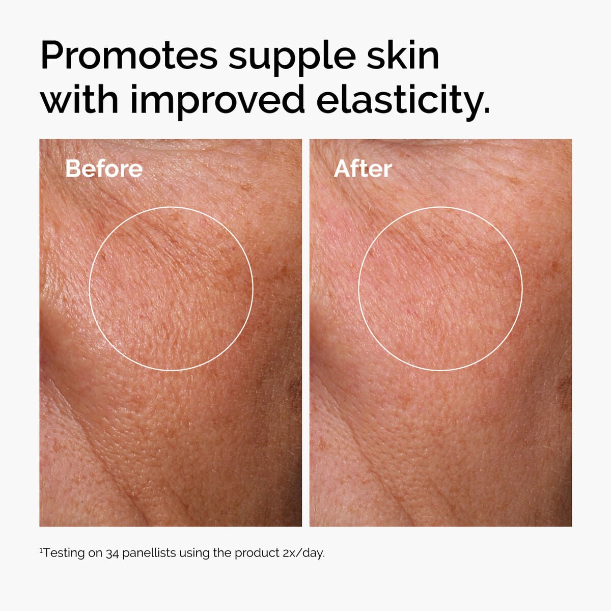 hyaluronic-acid-2-b5-with-ceramides-y7 ord-hyaluronic-acid-2pct-b5-hydrating-serum-before-after-elasticity.jpg