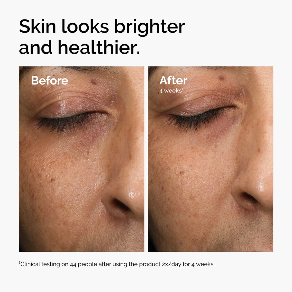 multi-antioxidant-radiance-serum-t4 ord-mars-before-after-healthy.jpg