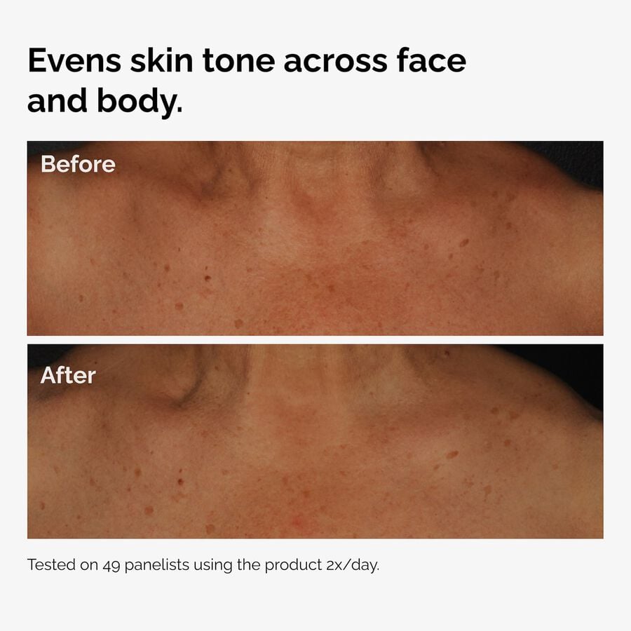 the-body-care-collection-e1 ord-niacinamide-face-body-serum-before-after-even-tone-graphic.jpg