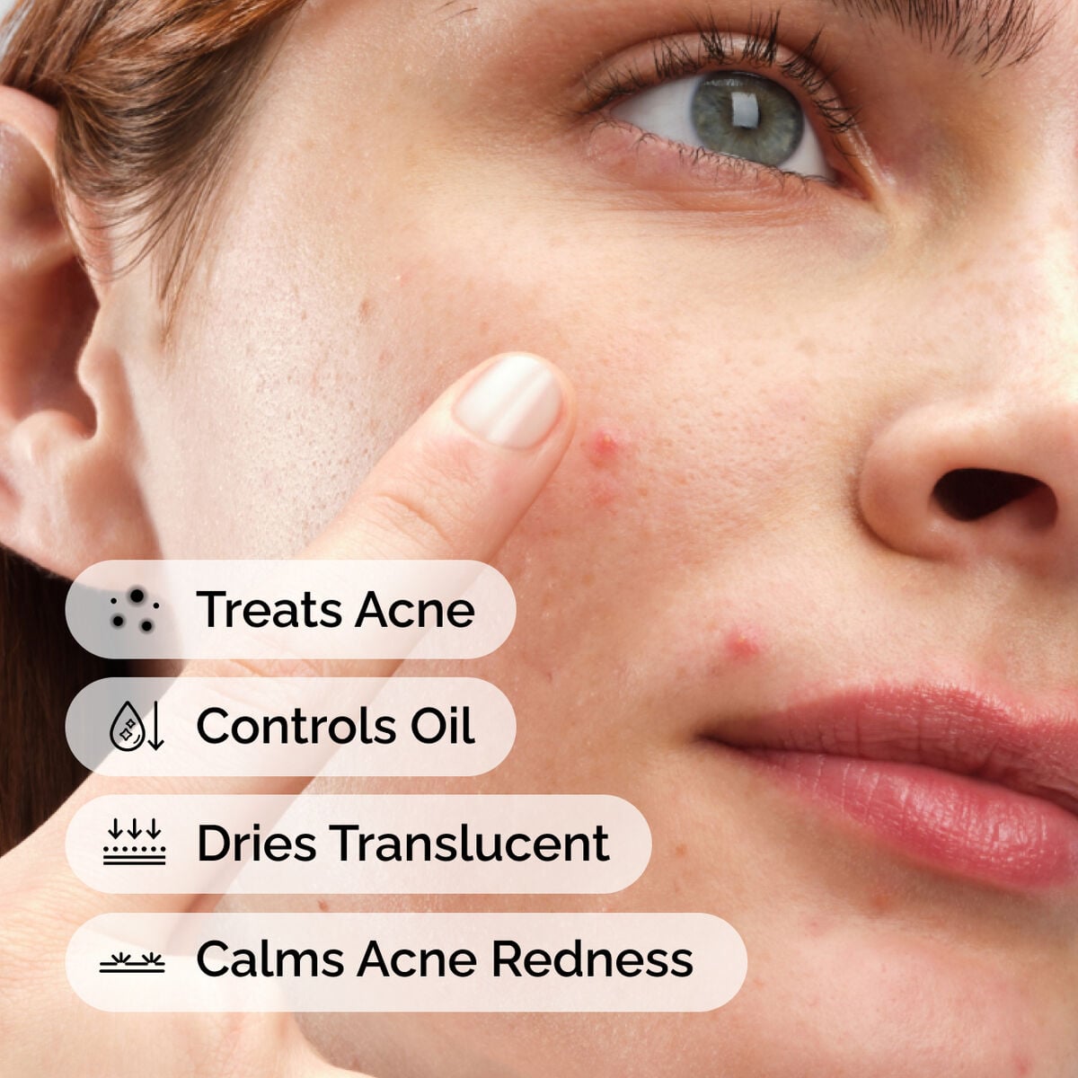 sulfur-10-powder-to-cream-concentrate-k4 ord-sulfur-10pct-powder-to-cream-concentrate-model-application-with-benefits-acne.jpg
